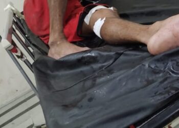 Fue herido por resistirse al robo