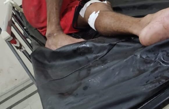 Fue herido por resistirse al robo