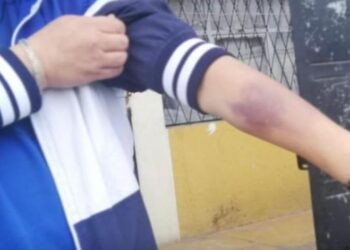 Hombre de 40 años denunció a su madre de maltratarlo acusándolo de mantenido