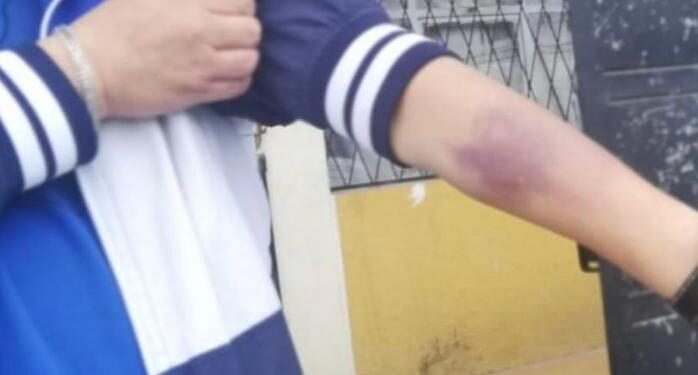 Hombre de 40 años denunció a su madre de maltratarlo acusándolo de mantenido