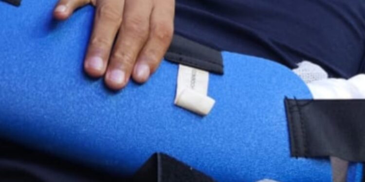 Guardia de seguridad herido en un intento de asalto