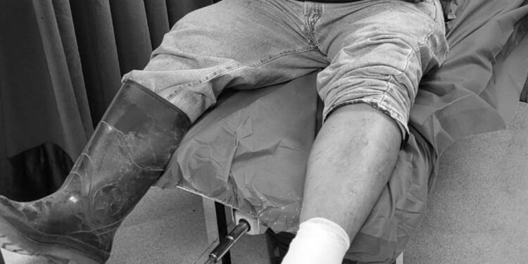 Delincuentes vestidos de jornaleros le dispararon