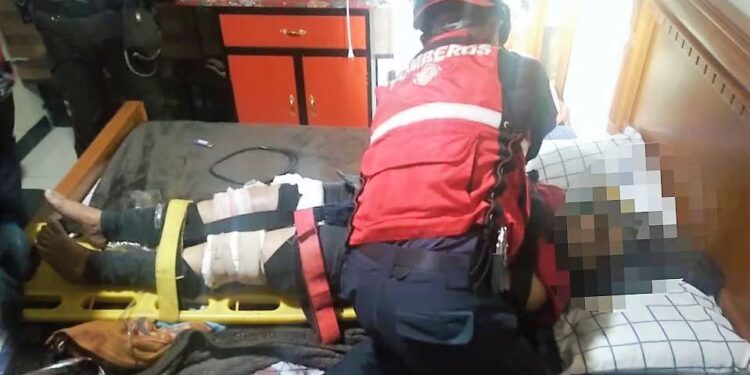Hombre disparó en la pierna a su conviviente y después se quitó la vida
