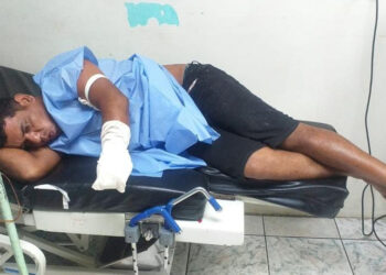 Hombre perdió la mano en una riña con machetes